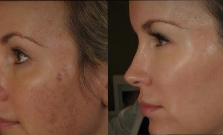 Belleza Gelinlik ve kuaför Salonu